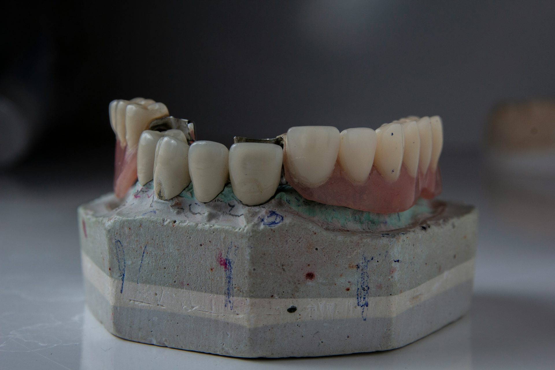 a close up of a tooth model on a table